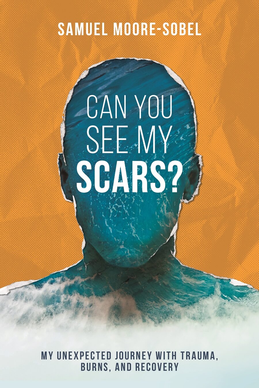 Can You See My Scars book cover